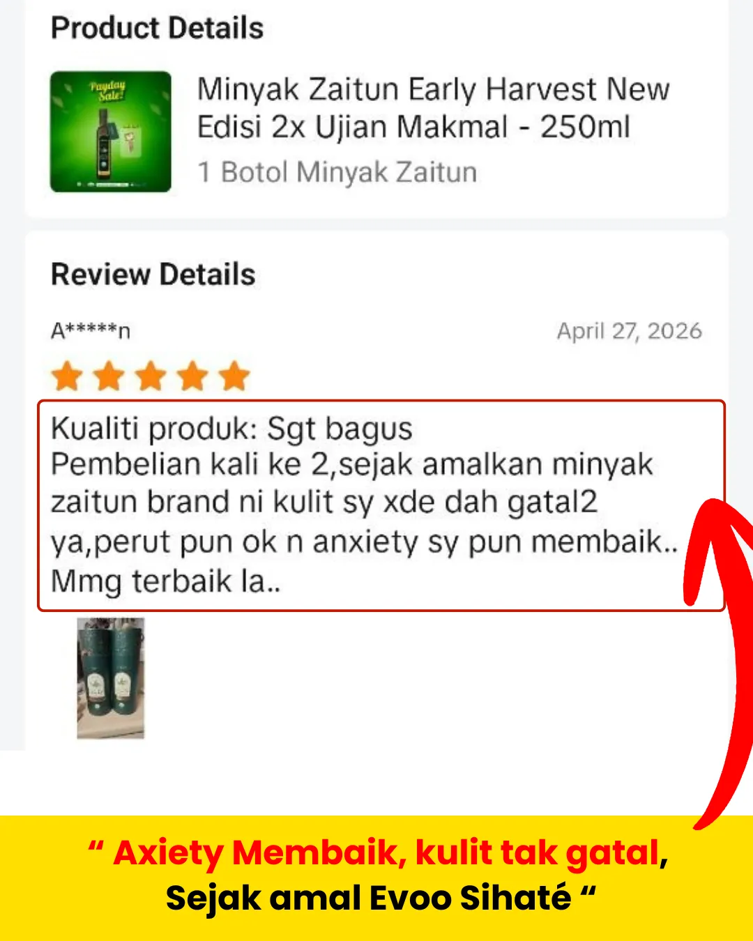 Anxiety dan Kulit Gatal